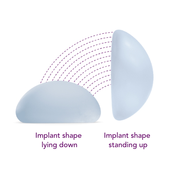 Round Implant